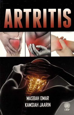 Artritis 