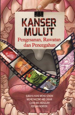 Kanser Mulut: Pengesanan, Rawatan dan Pencegahan 