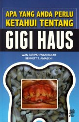 Apa Yang Anda Perlu Ketahui Tentang Gigi Haus