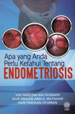 Apa yang Anda Perlu Ketahui Tentang Endometriosis 